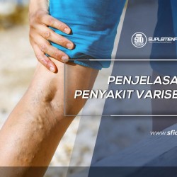 Penjelasan Lengkap Penyakit Varises